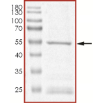 JAK2 (JH2) (V617F W659A W777A F794H) Protein
